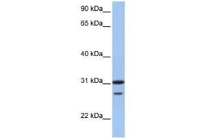 WB Suggested Anti-UBE2C Antibody Titration:  0. (UBE2C Antikörper  (N-Term))