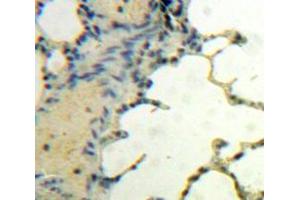 Used in DAB staining on fromalin fixed paraffin-embedded Lung tissue (BDNF Antikörper  (AA 139-249))