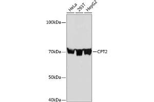 Western blot analysis of extracts of various cell lines, using CPT2 Rabbit mAb (ABIN7266090) at 1:1000 dilution. (CPT2 Antikörper)