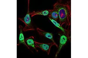 Immunofluorescence (IF) image for anti-Nibrin (NBN) (AA 467-615) antibody (ABIN1724942)