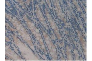 IHC-P analysis of Mouse Intestine Tissue, with DAB staining. (COMP Antikörper  (AA 554-753))