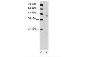 Image no. 1 for anti-DEAH (Asp-Glu-Ala-His) Box Polypeptide 30 (DHX30) (AA 51-100) antibody (ABIN6736327) (DHX30 Antikörper  (AA 51-100))