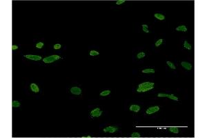 Immunofluorescence of monoclonal antibody to ASF1B on HeLa cell. (ASF1B Antikörper  (AA 1-202))