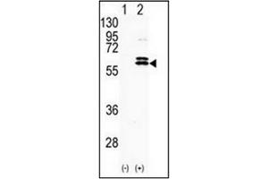 Western blot analysis of CDKL2 (arrow) using CDKL2 antibody (Center) Cat. (CDKL2 Antikörper  (AA 233-263))