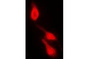 Immunofluorescent analysis of p38 (pY182) staining in HepG2 cells. (MAPK14 Antikörper  (pTyr182))