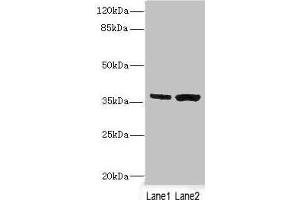 Western blot All lanes: C1GALT1C1 antibody at 3. (C1GALT1C1 Antikörper  (AA 30-190))
