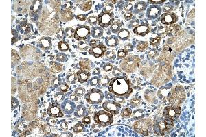 ST14 antibody was used for immunohistochemistry at a concentration of 4-8 ug/ml to stain Epithelial cells of renal tubule (arrows) in Human Kidney.