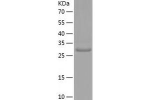 Western Blotting (WB) image for Adenosylmethionine Decarboxylase 1 (AMD1) (AA 68-334) protein (His tag) (ABIN7121713)