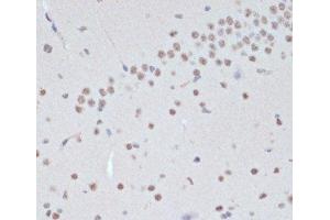 Immunohistochemistry of paraffin-embedded Mouse brain using Phospho-Jak2(Y1007/1008) Polyclonal Antibody at dilution of 1:200 (40x lens). (JAK2 Antikörper  (pTyr1007, pTyr1008))