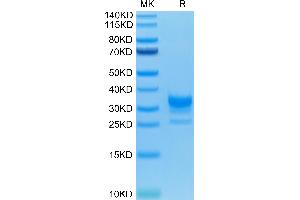 FCGR2B Protein (AA 46-217) (His-Avi Tag)