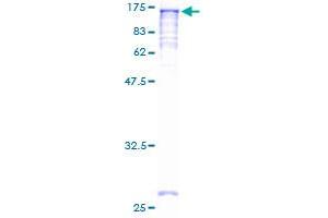 NAT10 Protein (AA 1-1025) (GST tag)