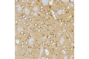 Immunohistochemistry of paraffin-embedded rat brain using Syntaxin 16 Rabbit mAb (ABIN7270681) at dilution of 1:50 (40x lens). (Syntaxin 16 Antikörper)