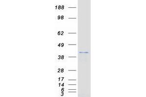 Validation with Western Blot