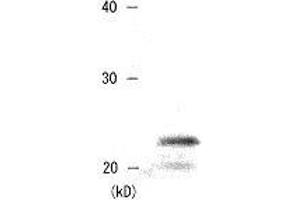 Western Blotting (WB) image for anti-Chromobox Homolog 5 (CBX5) (AA 179-191) antibody (ABIN2452033)