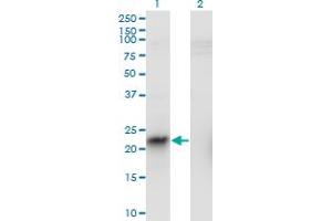 Western Blotting (WB) image for anti-Integrin beta 3 Binding Protein (Beta3-Endonexin) (ITGB3BP) (AA 1-100) antibody (ABIN565076)
