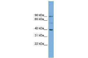 WB Suggested Anti-HFE  Antibody Titration: 0. (HFE Antikörper  (N-Term))