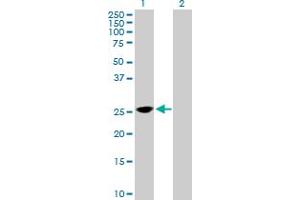 Western Blot analysis of TPD52 expression in transfected 293T cell line by TPD52 MaxPab polyclonal antibody. (TPD52 Antikörper  (AA 1-184))