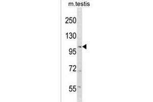 RANBP17 Antibody (N-term) (ABIN1539077 and ABIN2849983) western blot analysis in mouse testis tissue lysates (35 μg/lane). (RANBP17 Antikörper  (N-Term))