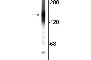 Western blot of rat cortical lysate showing specific immunolabeling of the ~160 kDa adenylate cyclase III protein.