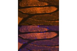 Immunofluorescence analysis of mouse skeletal muscle using α-Actin-1  Rabbit mAb (ABIN1682816, ABIN7101454, ABIN7101455 and ABIN7101456) at dilution of 1:100 (40x lens). (Actin (Alpha-Actin) Antikörper)
