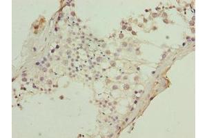 Immunohistochemistry (IHC) image for anti-Keratin 8 (KRT8) (AA 1-300) antibody (ABIN7157468)
