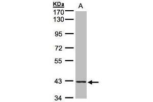 WB Image Sample (30μg whole cell lysate) A:HeLa S3, 7. (PRPSAP2 Antikörper)