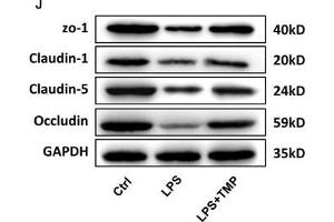 TMP has a protective effect on the LPS-induced BBB destruction in sepsis. (Occludin Antikörper  (AA 263-522))