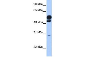 WB Suggested Anti-KLC3 Antibody Titration: 0. (KLC3 Antikörper  (Middle Region))