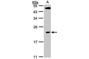 WB Image Sample(30 ug whole cell lysate) A:293T 12% SDS PAGE antibody diluted at 1:500 (TPRKB Antikörper)
