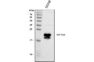 Western blot analysis of NPC2 using anti-NPC2 antibody (ABIN7600520).