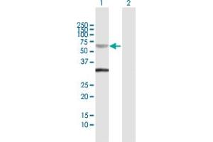SMAD6 antibody  (AA 1-496)