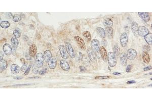 anti-Mitogen-Activated Protein Kinase Associated Protein 1 (MAPKAP1) (C-Term) antibody