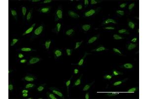 Immunofluorescence of monoclonal antibody to PTTG1 on HeLa cell. (PTTG1 Antikörper  (AA 93-113))