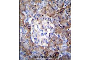TIMP1 Antibody immunohistochemistry analysis in formalin fixed and paraffin embedded human pancreas tissue followed by peroxidase conjugation of the secondary antibody and DAB staining. (TIMP1 Antikörper  (C-Term))