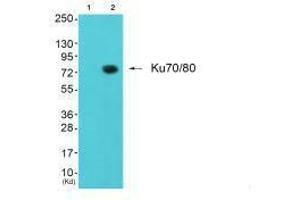 Western blot analysis of extracts from JK cells (Lane 2), using Ku80 antiobdy. (XRCC6 Antikörper)