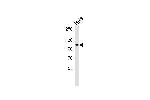 HK2 Antibody  (ABIN392755 and ABIN2842207) western blot analysis in Hela cell line lysates (35 μg/lane). (Hexokinase 2 Antikörper  (N-Term))