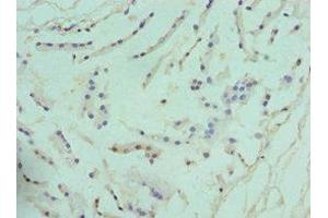 Immunohistochemistry (IHC) image for anti-Arginase, Type II (ARG2) (AA 1-354) antibody (ABIN7144586)