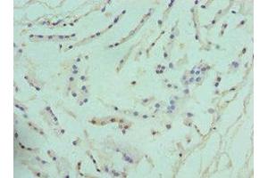 Immunohistochemistry of paraffin-embedded human prostate tissue using ABIN7144586 at dilution of 1:100 (ARG2 Antikörper  (AA 1-354))