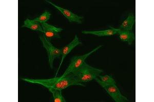 anti-tRNA Splicing Endonuclease 34 Homolog (TSEN34) (AA 1-310) antibody