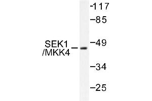 Image no. 1 for anti-Mitogen-Activated Protein Kinase Kinase 4 (MAP2K4) antibody (ABIN271811) (MAP2K4 Antikörper)