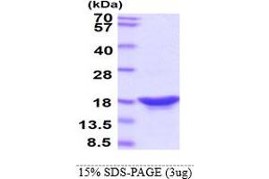SDS-PAGE (SDS) image for Synuclein, beta (SNCB) protein (ABIN666819) (beta Synuclein Protein)