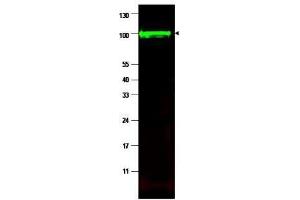 Western blot using  affinity purified anti-iASPP antibody shows detection of a band at ~100 kDa (arrowhead) corresponding to isoform 1 of iASPP in MCF7 whole cell lysates. (PPP1R13L Antikörper  (Isoform 1))