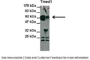 Lanes:   Lane 1 and 2: 30 ug HEK-293 cell lysate  Primary Antibody Dilution:   1:1000  Secondary Antibody:   Anti-Rabbit HRP  Secondary Antibody Dilution:   1:2000  Gene Name:   Tmed1  Submitted by:   Anonymous (TMED1 Antikörper  (N-Term))
