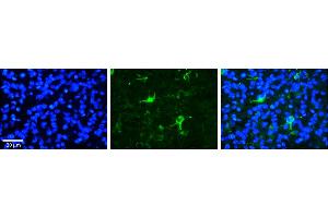 Immunohistochemistry (IHC) image for anti-F-Box and WD Repeat Domain Containing 7 (FBXW7) (C-Term) antibody (ABIN2782955)