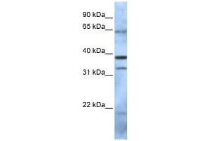PCGF5 antibody used at 1 ug/ml to detect target protein. (PCGF5 Antikörper  (N-Term))