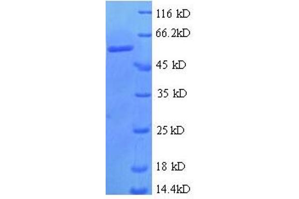 ZNF384 Protein (AA 1-245, partial) (GST tag)