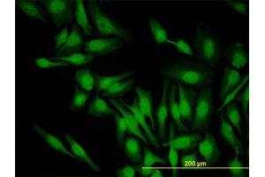 Image no. 2 for anti-PDZ Binding Kinase (PBK) (AA 1-110) antibody (ABIN599275) (PBK Antikörper  (AA 1-110))