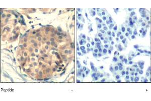 Image no. 1 for anti-Mast/stem Cell Growth Factor Receptor (KIT) (AA 934-938) antibody (ABIN401646) (KIT Antikörper  (AA 934-938))