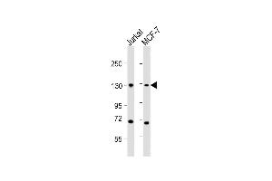 All lanes : Anti-CTCF Antibody (Center) at 1:2000 dilution Lane 1: Jurkat whole cell lysates Lane 2: MCF-7 whole cell lysates Lysates/proteins at 20 μg per lane. (CTCF Antikörper  (AA 334-364))