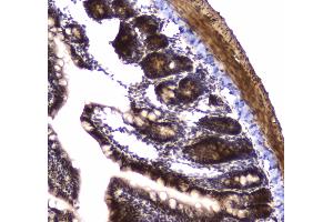 IHC analysis of POLR2A using anti-POLR2A antibody . (POLR2A/RPB1 Antikörper  (AA 1148-1384))